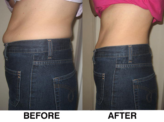 no name 1 Fitness Boot Camp Bournemouth Delivers Results Through his Boot Camps